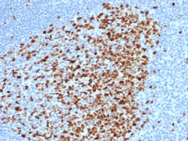 Topoisomerase II alpha Antibody in Immunohistochemistry (Paraffin) (IHC (P))