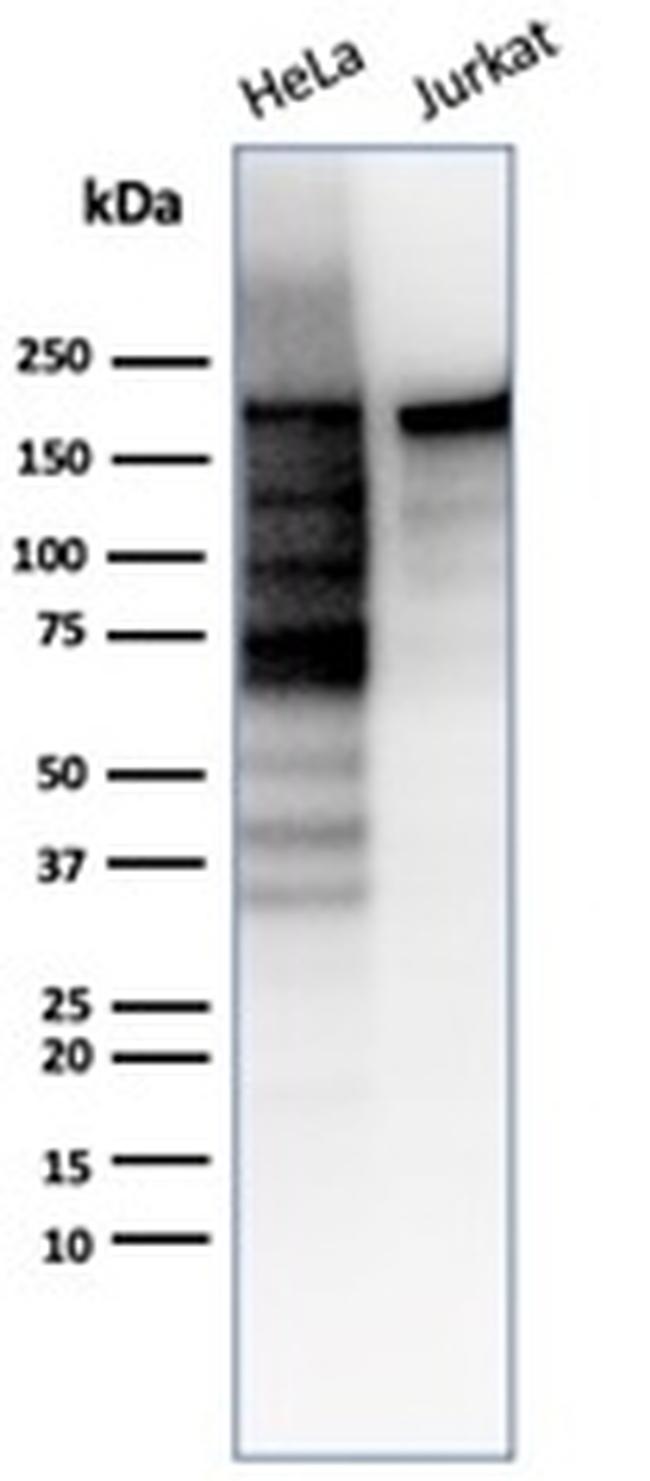 Topoisomerase II alpha Antibody in Western Blot (WB)