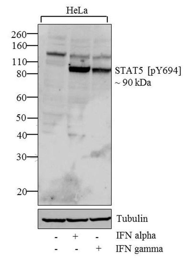 Phospho-STAT5 alpha (Tyr694) Antibody