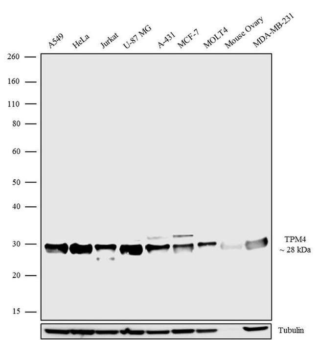 TPM4 Antibody in Western Blot (WB)