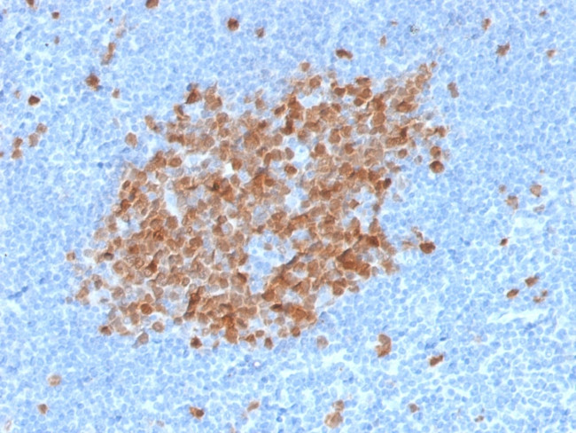 Thymidylate Synthase Antibody in Immunohistochemistry (Paraffin) (IHC (P))