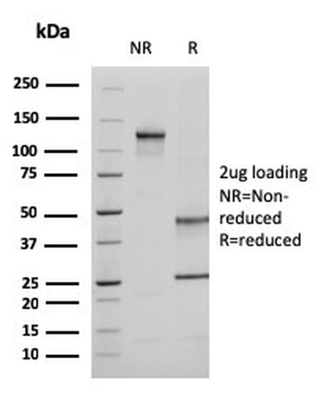 Ezrin/p81 Antibody