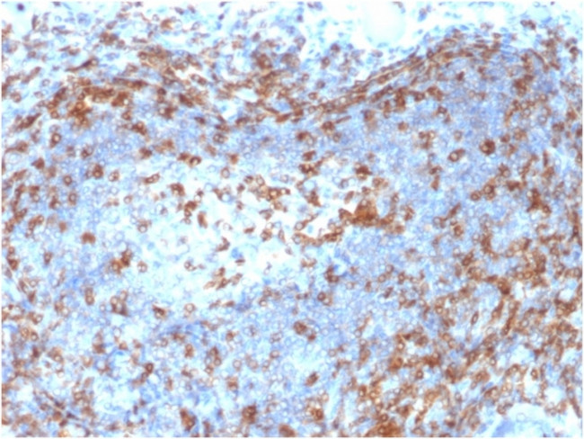 ZAP70 Antibody in Immunohistochemistry (Paraffin) (IHC (P))