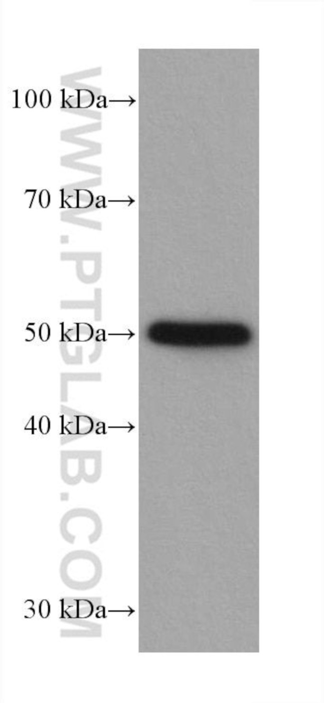 P53 Antibody in Western Blot (WB)