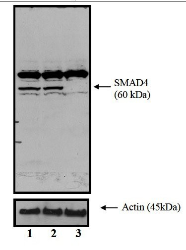 SMAD4 Antibody in Western Blot (WB)