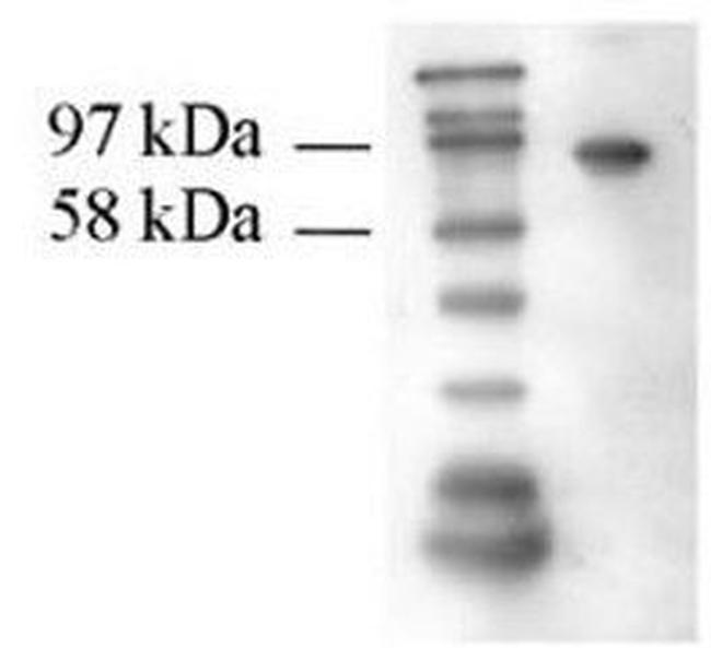 Transglutaminase-2 (TG2) Antibody in Western Blot (WB)