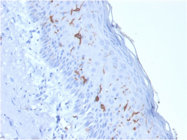 CD1a/HTA1 Antibody in Immunohistochemistry (Paraffin) (IHC (P))