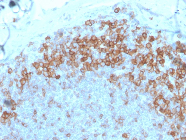 CD27 (Tumor Necrosis Factor Receptor Superfamily 7) Antibody in Immunohistochemistry (Paraffin) (IHC (P))