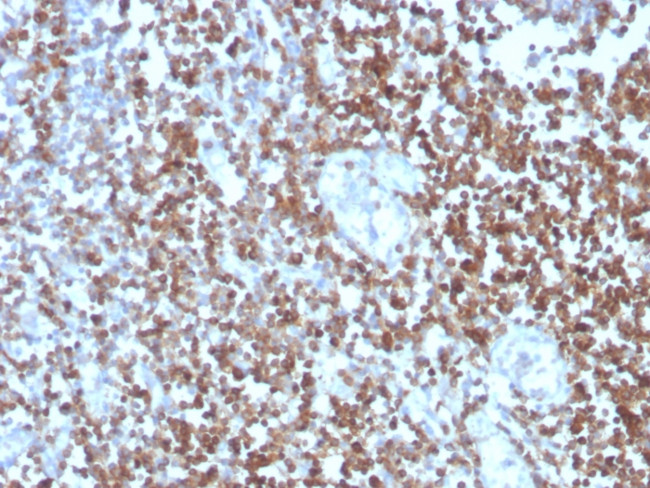 CD27 (Tumor Necrosis Factor Receptor Superfamily 7) Antibody in Immunohistochemistry (Paraffin) (IHC (P))