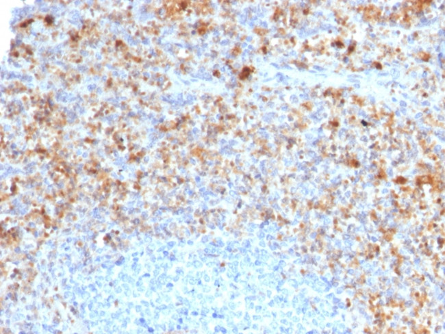 CD40 Ligand/CD154/TRAP1 (Activation Marker of T-Lymphocytes) Antibody in Immunohistochemistry (Paraffin) (IHC (P))