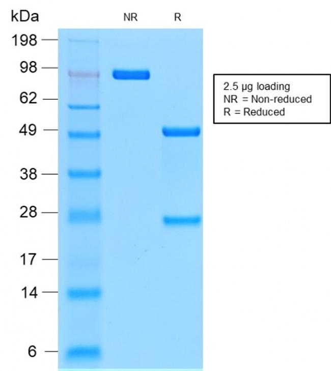 CD44v9 Antibody in SDS-PAGE (SDS-PAGE)