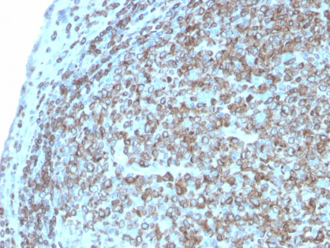 CD74 Antibody in Immunohistochemistry (Paraffin) (IHC (P))