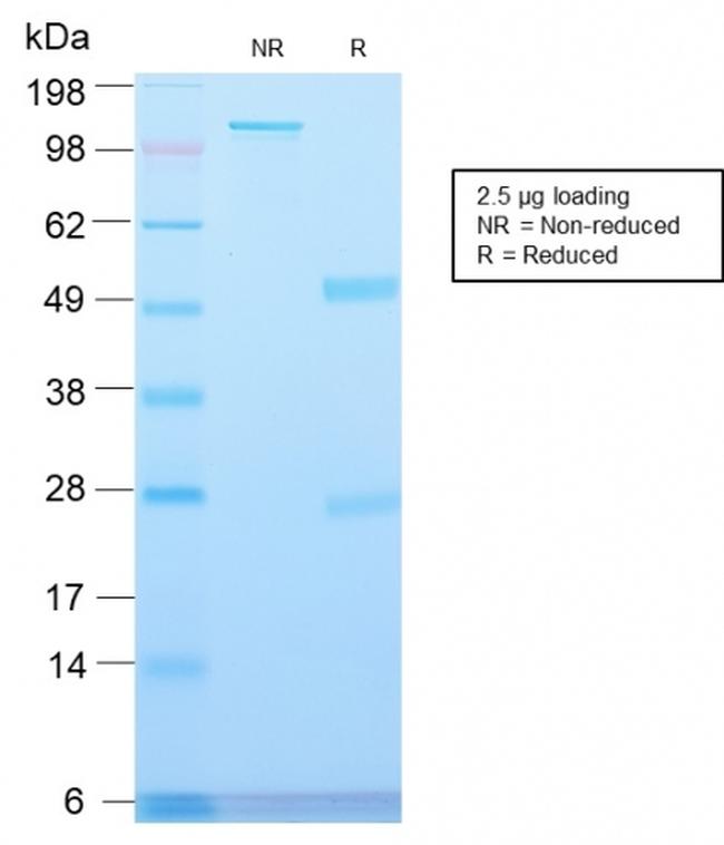 Major Vault Protein (MVP) Antibody in SDS-PAGE (SDS-PAGE)