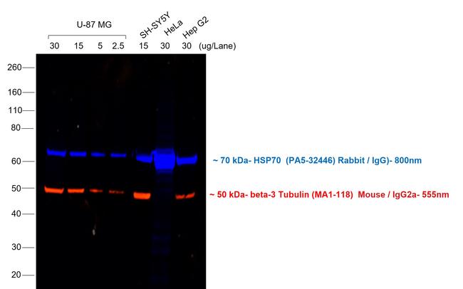 Mouse IgG2a Cross-Adsorbed Secondary Antibody in Western Blot (WB)