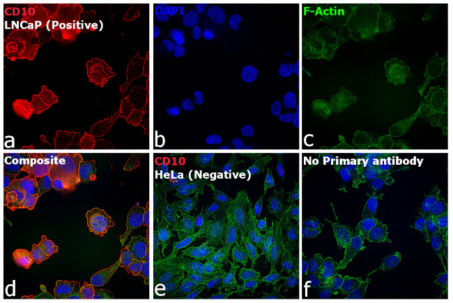 Mouse IgG2b Cross-Adsorbed Secondary Antibody in Immunocytochemistry (ICC/IF)