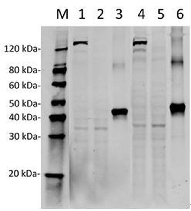 SpCas9 Antibody in Western Blot (WB)