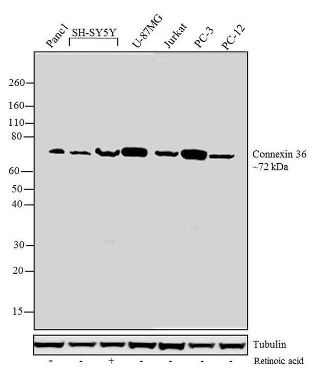 Rabbit IgG (Heavy chain) Secondary Antibody in Western Blot (WB)