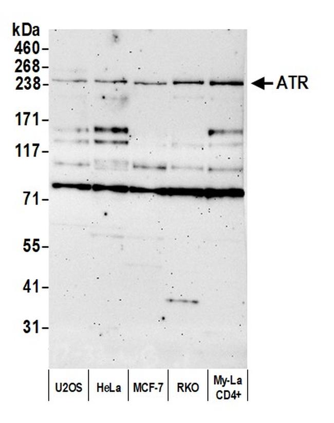 ATR Antibody in Western Blot (WB)