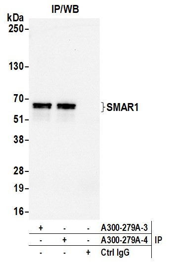 SMAR1/BANP Antibody in Immunoprecipitation (IP)