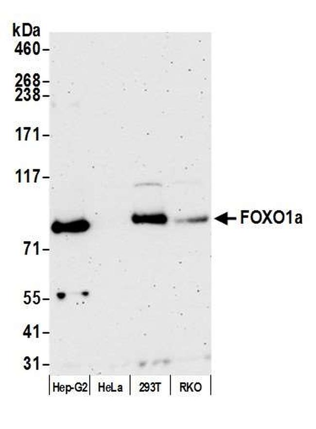 FOXO1a Antibody in Western Blot (WB)