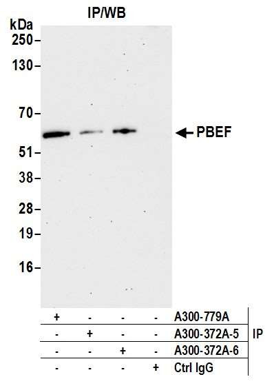 NAMPT/PBEF/Visfatin Antibody in Immunoprecipitation (IP)