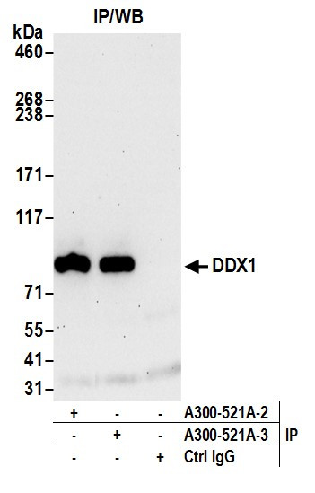 DDX1 Antibody in Immunoprecipitation (IP)