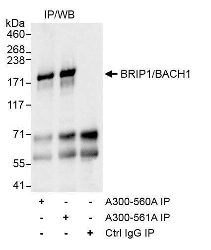 BRIP1 Antibody in Immunoprecipitation (IP)