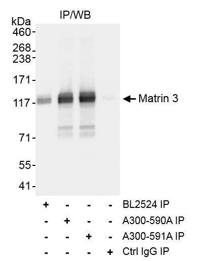 Matrin 3 Antibody in Immunoprecipitation (IP)
