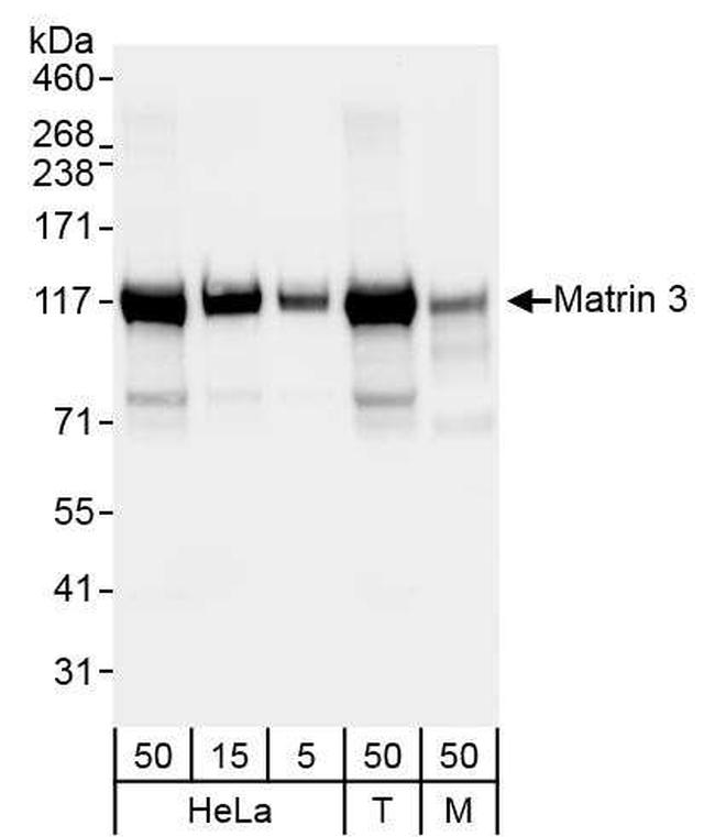 Matrin 3 Antibody in Western Blot (WB)