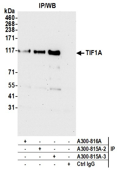 TIF1 Alpha/TRIM24 Antibody in Immunoprecipitation (IP)