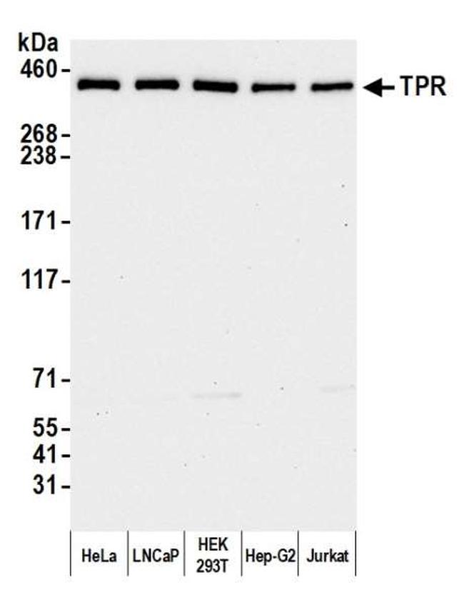 TPR Antibody in Western Blot (WB)