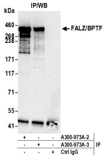 FALZ/BPTF Antibody in Immunoprecipitation (IP)