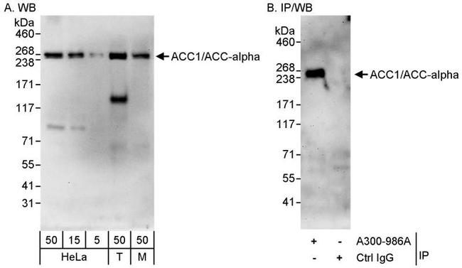ACC1/ACC-alpha Antibody in Western Blot (WB)