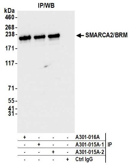 SMARCA2/BRM Antibody in Immunoprecipitation (IP)