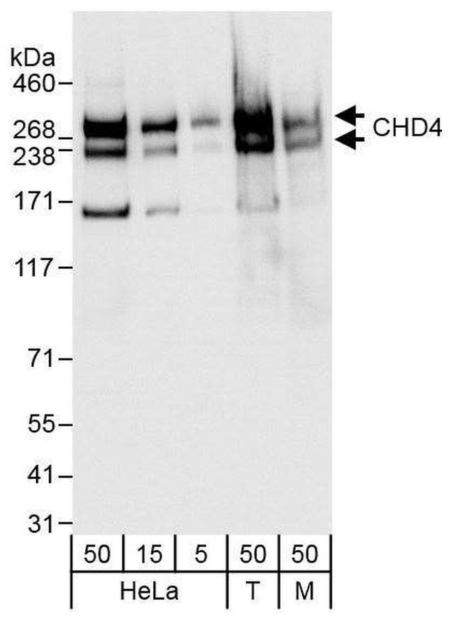 CHD4/Mi2 beta Antibody in Western Blot (WB)