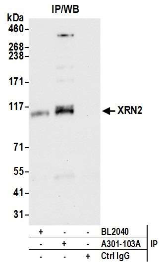 XRN2 Antibody in Immunoprecipitation (IP)