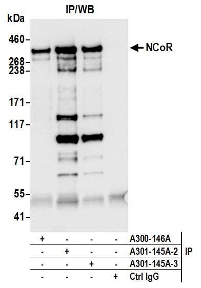 NCoR Antibody in Immunoprecipitation (IP)