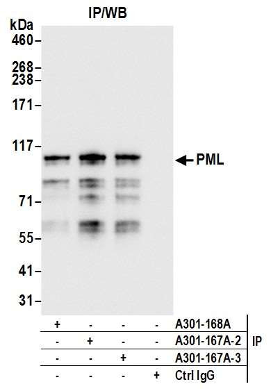 PML Antibody in Immunoprecipitation (IP)
