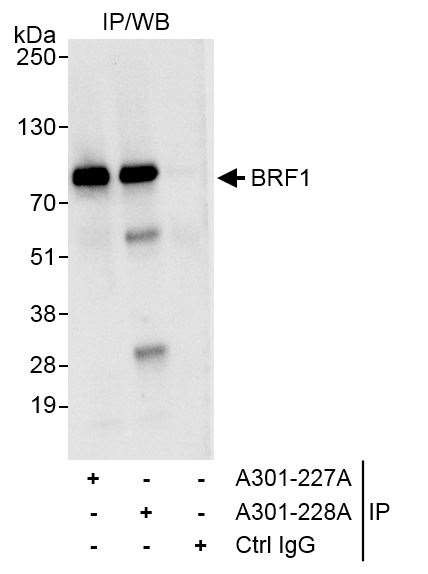 BRF1 Antibody in Immunoprecipitation (IP)