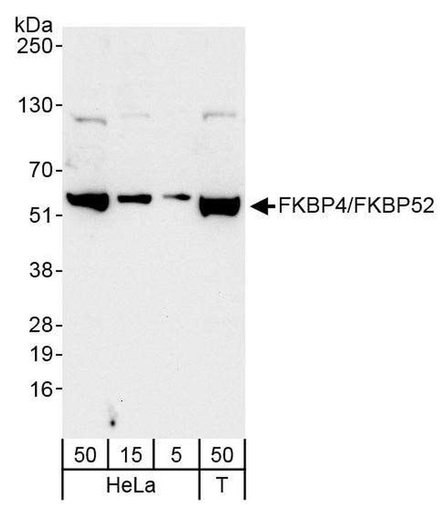 FKBP4/FKBP52 Antibody in Western Blot (WB)