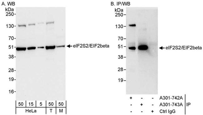 eIF2beta/EIF2S2 Antibody in Western Blot (WB)