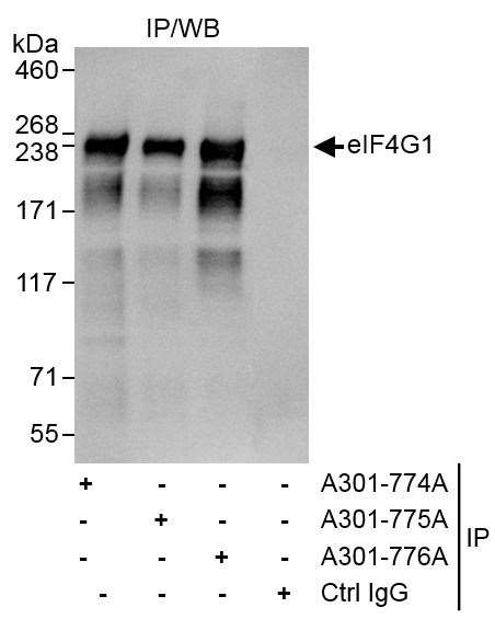 eIF4G1/eIF4GI Antibody in Immunoprecipitation (IP)