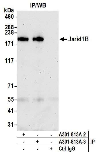 JARID1B Antibody in Immunoprecipitation (IP)