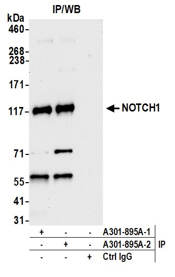 Notch1 Antibody in Immunoprecipitation (IP)