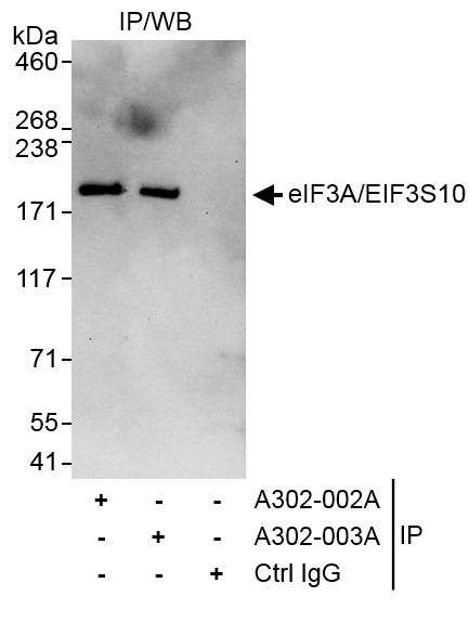 eIF3A/eIF3S10 Antibody in Immunoprecipitation (IP)