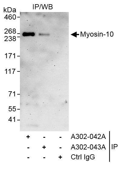 Myosin-10 Antibody in Immunoprecipitation (IP)