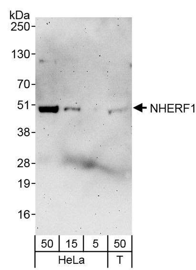 NHERF1 Antibody in Western Blot (WB)