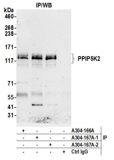 PPIP5K2 Antibody in Immunoprecipitation (IP)