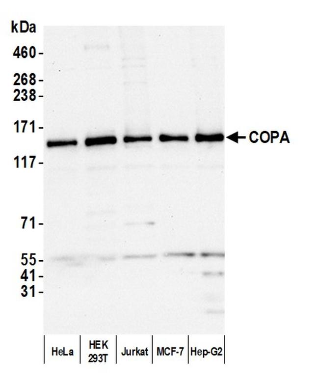 COPA Antibody in Western Blot (WB)