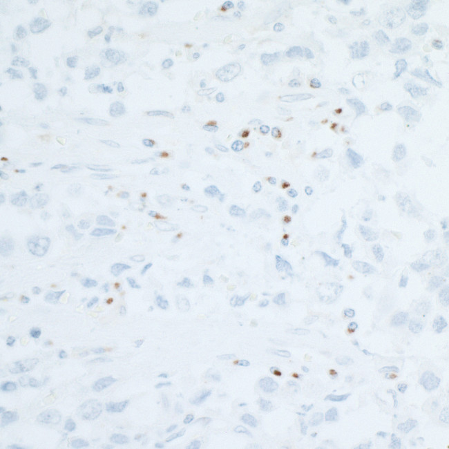 CD86 Antibody in Immunohistochemistry (Paraffin) (IHC (P))